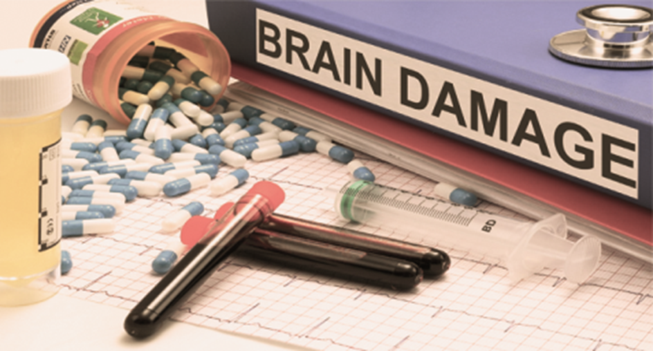 Drugs and Neuronal Damage