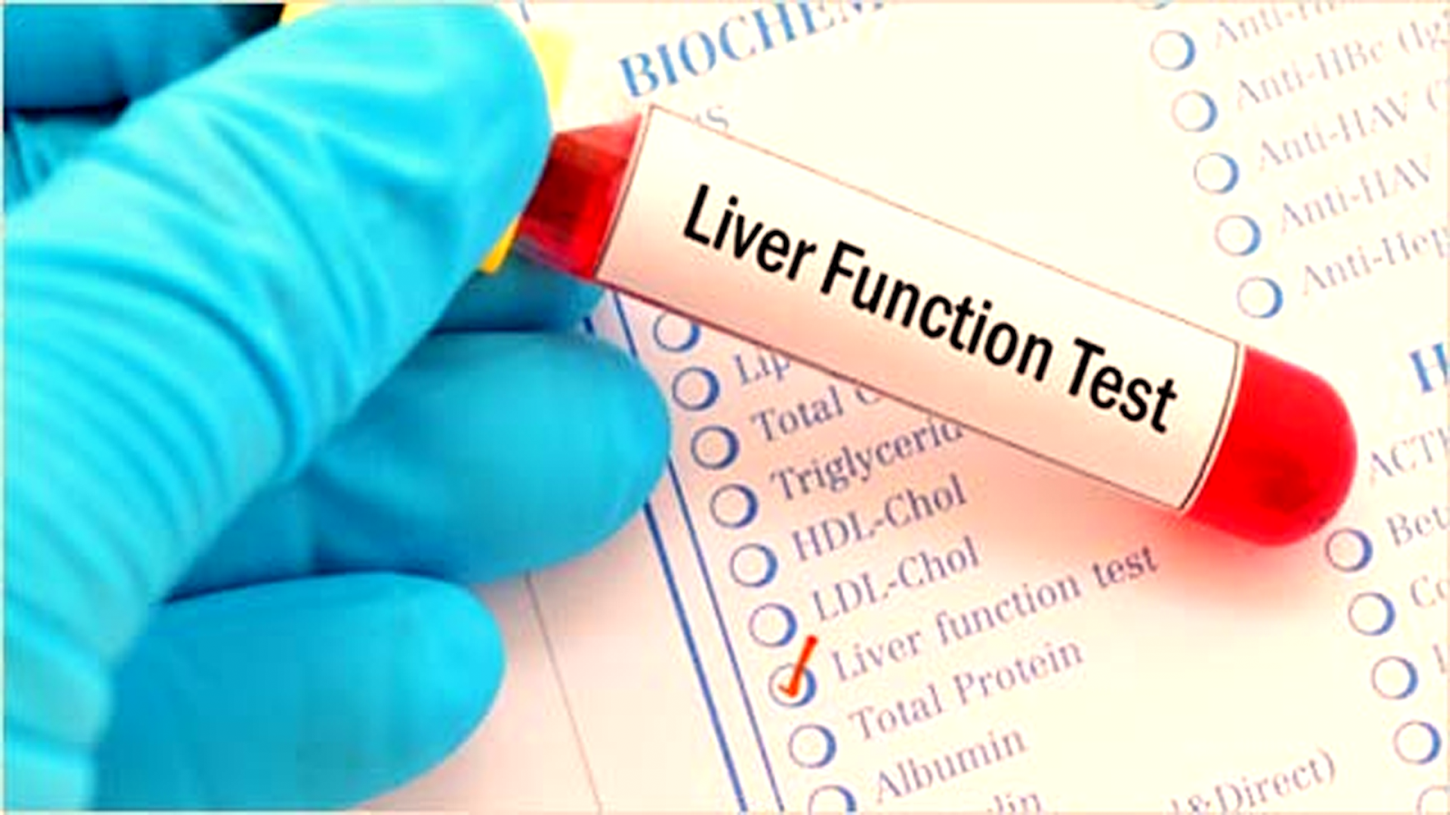 atorvastatin causing high alt and ast for 6 months